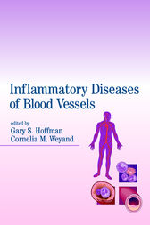 Inflammatory Diseases of Blood Vessels by Gary S. Hoffman